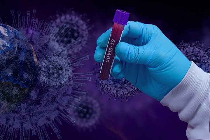 Gdzie najlepiej wykonać prywatnie test na koronawirusa?